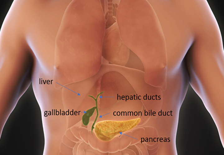 Cholecystectomy