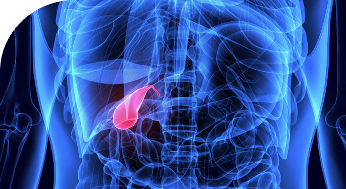 جراحی های کیسه صفرا