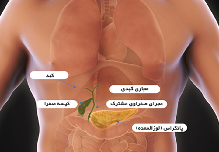 کوله¬سیستکتومی (1)