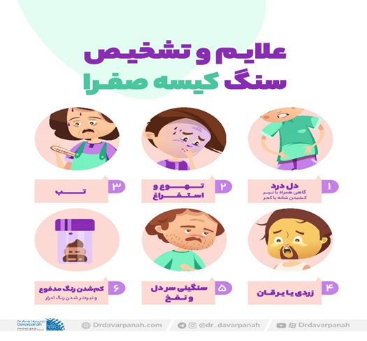 علائم سنگ کیسه صفرا