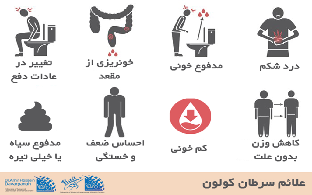 علائم سرطان کولون