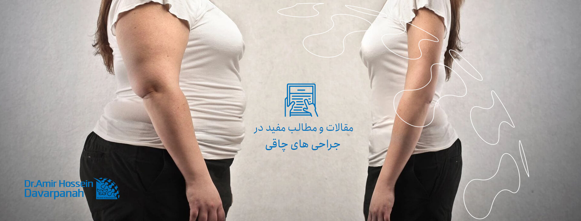 مطالب آموزشی، جراحی های چاقی